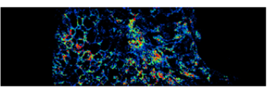 Frontiers in Microscopy & Microanalysis Seminar, New Frontiers in Maldi ...